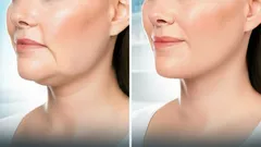 5 einfache Übungen, die schon nach wenigen Wochen für ein strafferes Gesicht sorgen – ganz ohne Kosmetikerin