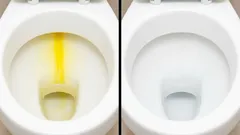 Hartes Wasser beschädigt die Toilettenschüssel – doch das lässt sich mit einem einfachen Hausmittel aus der Küche verhindern